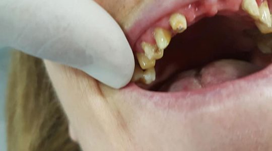 Chirurgia-oro-dentale